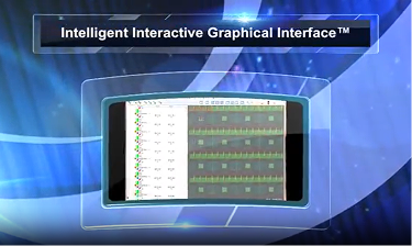 Intelligent Interactive Graphical Interface® - i2Gi®